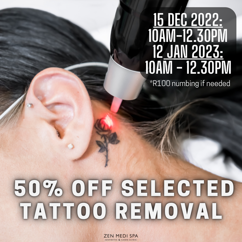 Tattoo Removal Thursdays