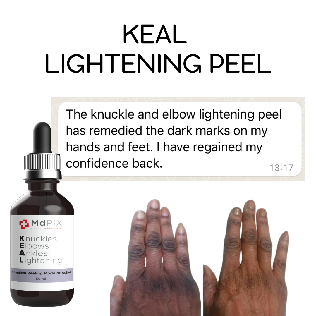 Md PIX KEAL Knuckle, Elbow, Ankle Lightening (50ml)